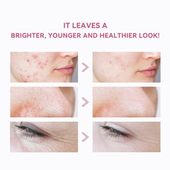 Scar Gold Modeling Peel off Mask Powder 500g - Modeling mask -Peel off mask - face mask - Albasel cosmetics